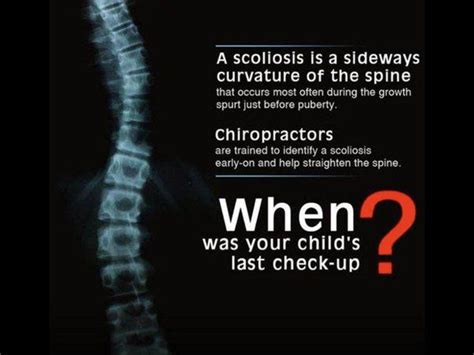 Do Chiropractors Do X Rays Before Treatment Trachteroegner 99