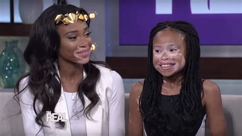 This Moment Between Winnie Harlow And A Young Fan Shows Why Beauty