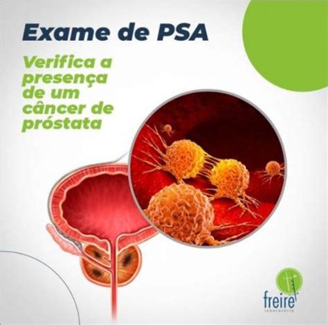 exame de psa