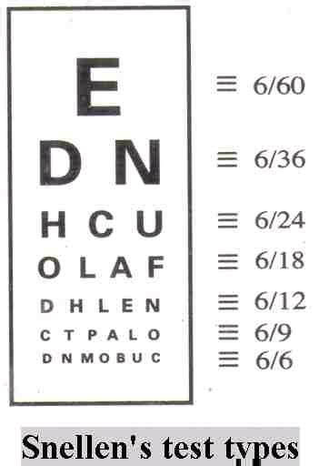 The snellen fractions were then 6/6, 6/12, and so on. Clear your doubts about Eye-Vision standards for Railway Exams