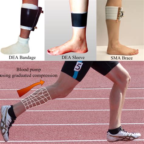 Leg Compression Therapy Menrva Research Group Simon Fraser University