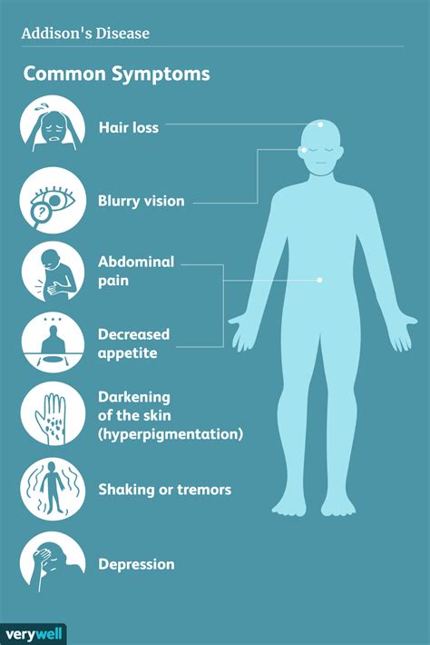 Addisons Disease Treatments And Symptoms To Watch For