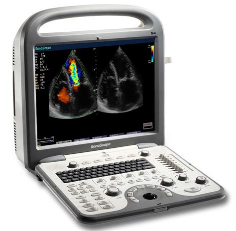 Sonoscape S8 Portable 4d Color Doppler Ultrasound Scanner Hospital