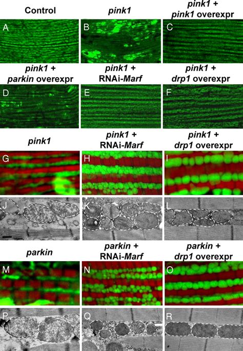 The Parkinsons Disease Genes Pink1 And Parkin Promote Mitochondrial