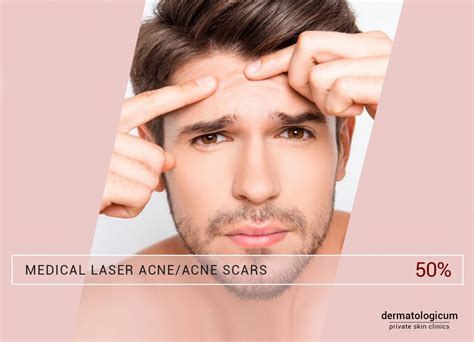 Medical Laser Acne And Acne Scars Dermatologicum