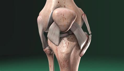 Mcl Medial Collateral Ligament Injury