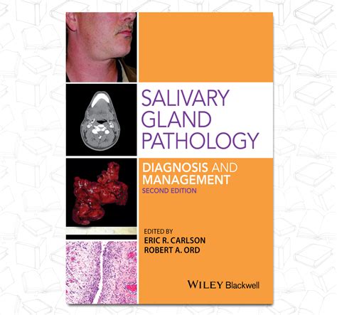 Salivary Gland Pathology Diagnosis And Management Dent13