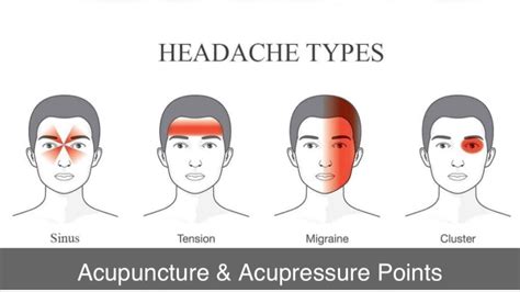 Acupuncture And Acupressure Point For Headache Youtube