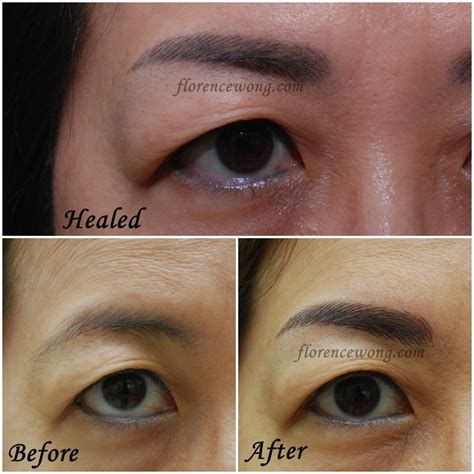 Elegant 3d Brow Embroidery ~ Before After And Healed Result Florence