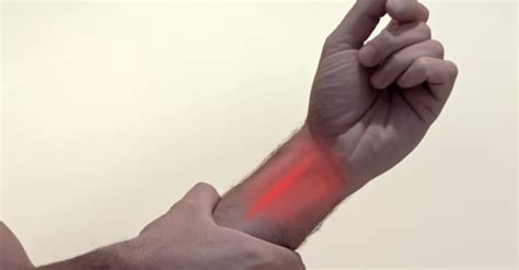 Carpal Tunnel Syndrome Vs A Pinched Nerve Elsewhere