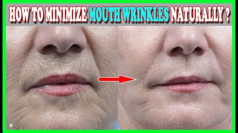 5 Natural Ways To Minimize Wrinkles Around Your Mouth Wrinkles