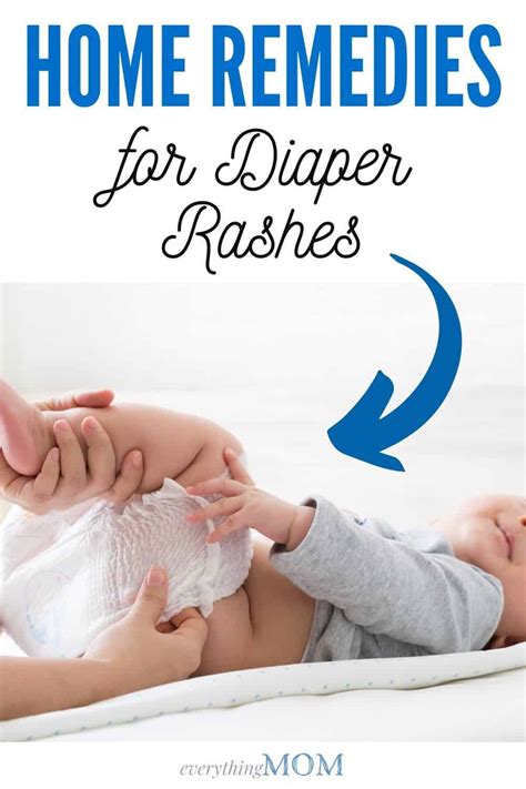 10 Home Remedies For Diaper Rash Everythingmom