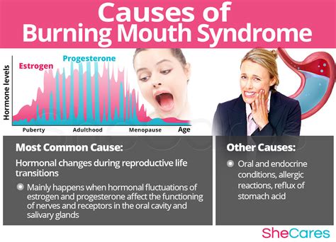 Burning Mouth Syndrome Bms Shecares