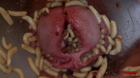 Maggots In Foreskin And Peehole Pt2