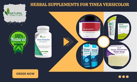 The Secret To Fighting Tinea Versicolor Fast And Easily