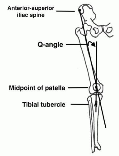 Lateral Retinacular Release And Lengthening Musculoskeletal Key