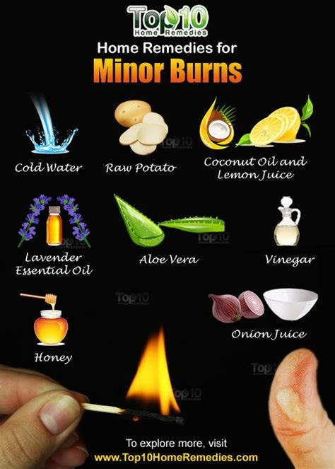 Home Remedies For Minor Burns Top 10 Home Remedies