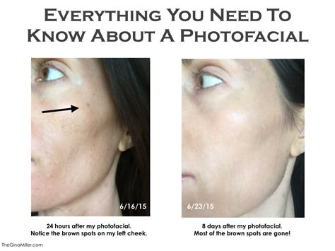 Photofacial Review Everything You Need To Know About This