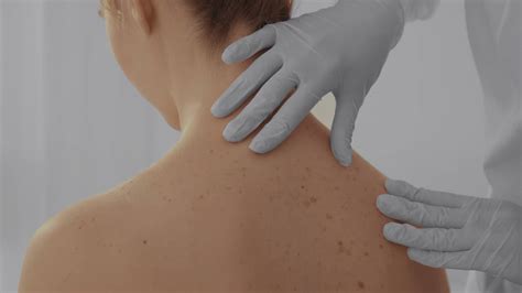 Medical Dermatology - Precision Skin Institute