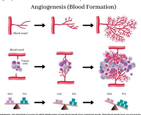 Pdf Angiogenesis In Breast Cancer Progression Diagnosis And Treatment Semantic Scholar