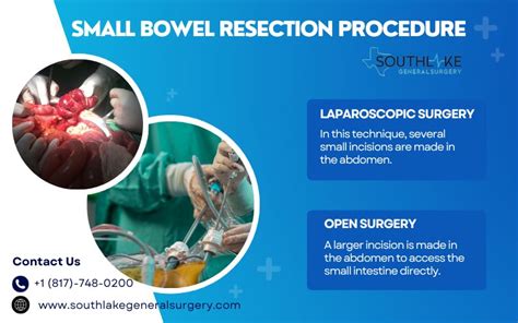 Understanding Small Bowel Resection Southlake General Surgery
