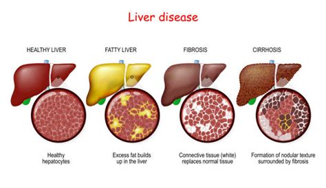 What Are The Stages Of Liver Failure In Dogs