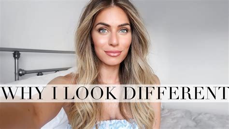 Why I Look Different Lydia Elise Millen Youtube