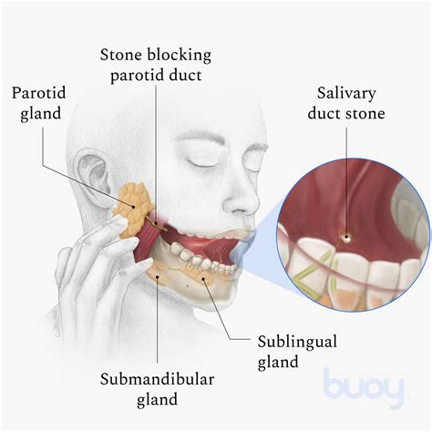 Blocked Salivary Gland Lip