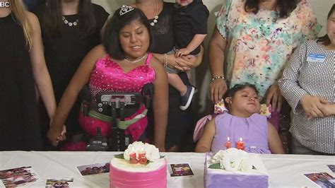 Formerly Conjoined Twins Celebrate 21st Birthday And 20th Anniversary