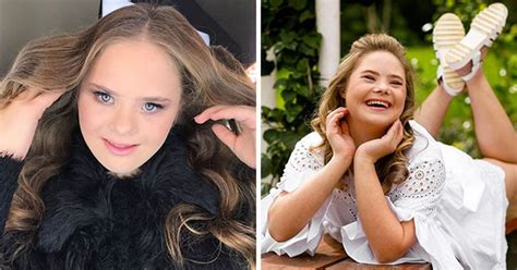 This Teen With Downs Syndrome Has Signed With 5 Modeling Agencies And Has 65k Followers On