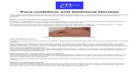 Paraumbilical And Umbilical Hernias The Hernia Clinic Hernia Repair