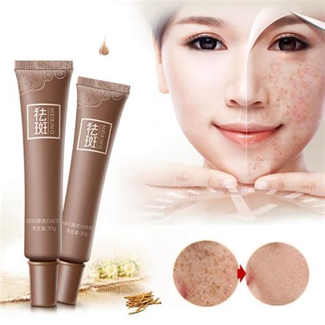 Best Face Cream For Dark Spots Wikilove