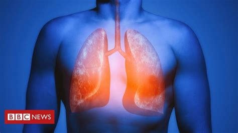 Study Lungs Magically Heal Damage From Smoking Tldr Some Lung