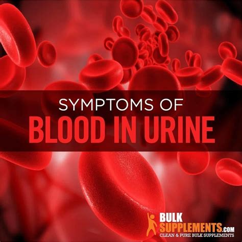 Tablo Read Blood In Urine Symptoms Causes And Treatment By