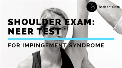 Shoulder Exam Neer Test For Shoulder Impingementsubacromial Bursitis