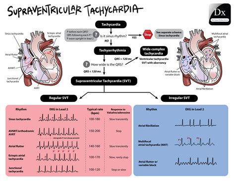 Supraventricular Tachycardia The Clinical Problem Solvers