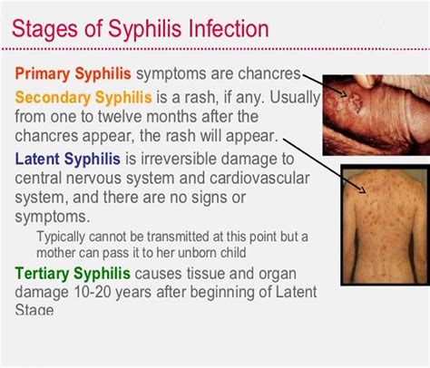 Syphilis Medication