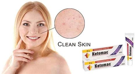 Ketoconazole Cream For Baby Face Ketoconazole Cream