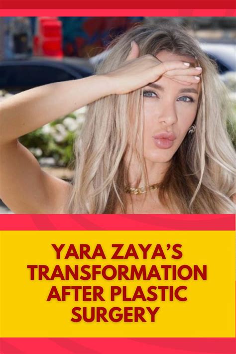 Yara Zayas Stunning Transformation Before And After Plastic Surgery