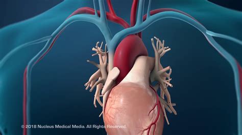 Coronary Artery Angioplasty Radial Access Hindi Youtube