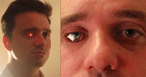 Eyeborg Canadian Rob Spence Replaces Eye With Video Camera آنکھ میں وائر لیس ویڈیو کیمرہ نصب