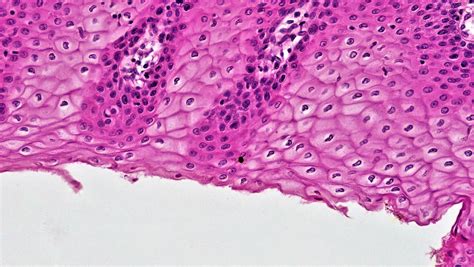 Epithelial Tissues Stratified Squamous Epithelium Flickr