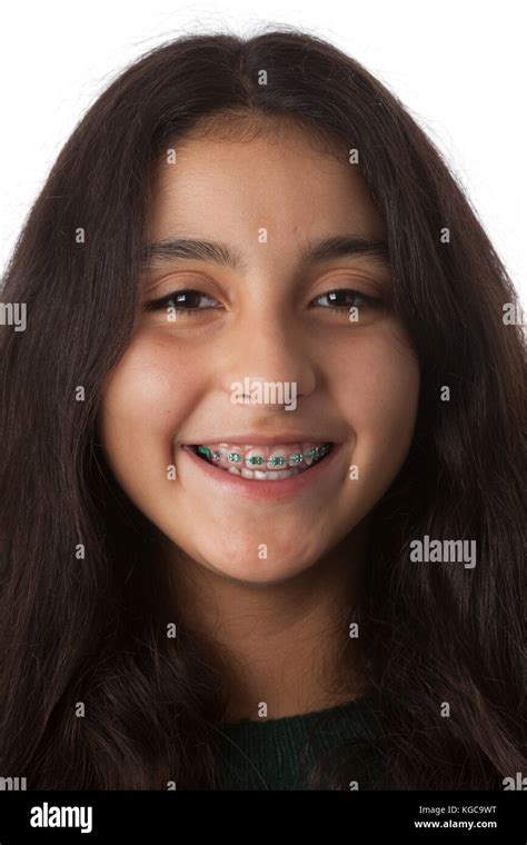 Portrait Of A Smiling Teenage Girl With Dental Braces Stock Photo Alamy