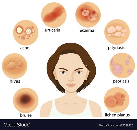 Diagram Showing Different Skin Conditions Vector Image
