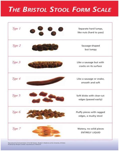 What Does Your Poo Look Like Bristol Stool Form Scale Stool Chart