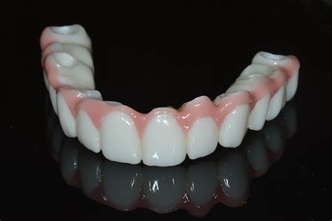 Dental Implants Portsmouth Nh Dentist 603 427 0043