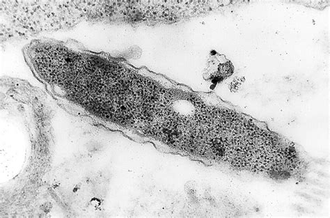 Free Picture Gram Negative Legionella Pneumophila Bacterium