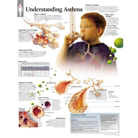 Scientific Publishing Understanding Asthma Condition Chart