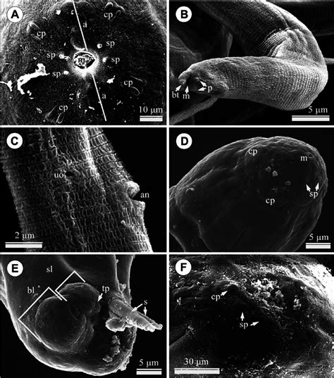 Scanning Electron Micrographs Of Philometra Isaki Sp N Ac And