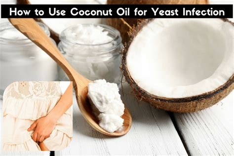 How To Use Coconut Oil For Yeast Infection Online Health Trainer